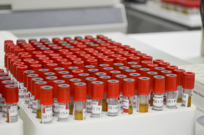 Вирус-убийца из Индии: новосибирский врач рассказал, кому грозит смертельная опасность